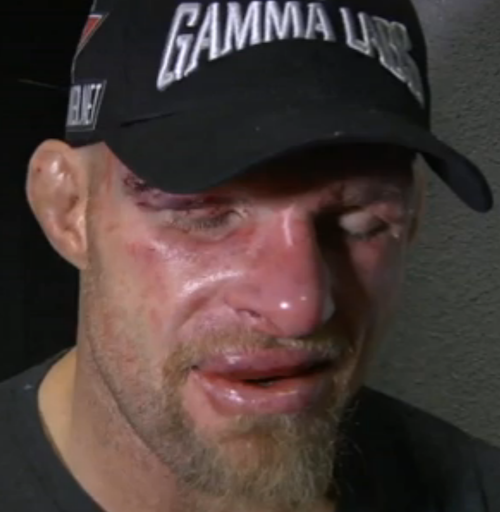 keith-jardine-post-fight-mousasi.png