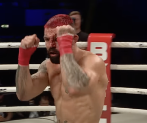 Bare Knuckle Fighting Championship: A Gritty Revival of Historical Combat